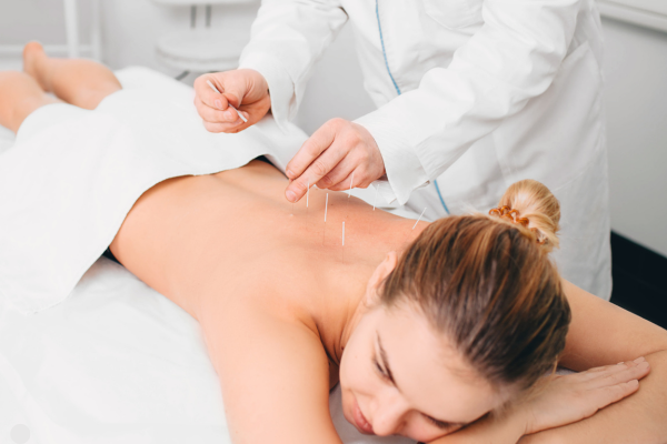 How Acupuncture Can Improve Your Overall Well-Being