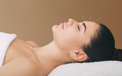 Acupuncture for Insomnia: A Natural Way to Restore Restful Sleep